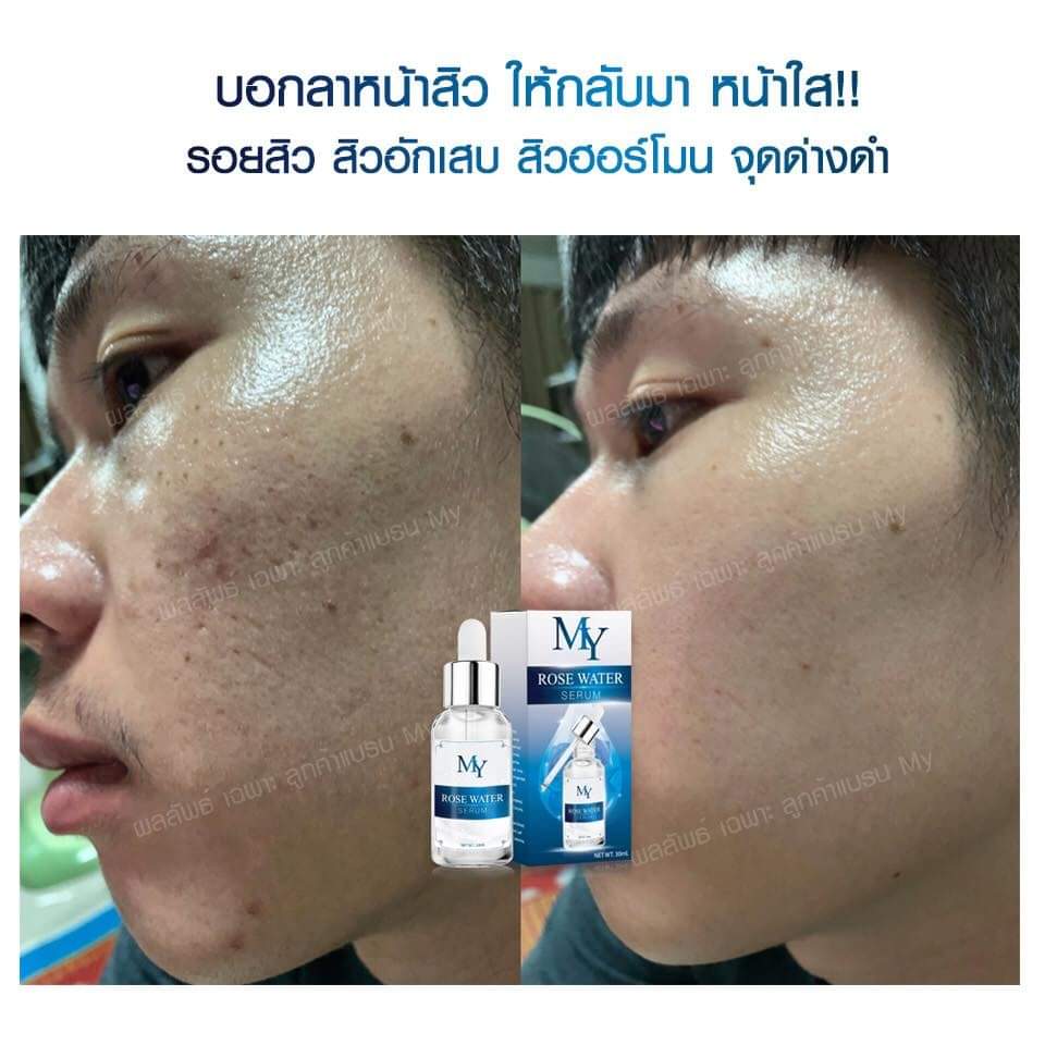 my rose serum เซรั่มสกัดจากน้ำดอกกุหลาบ และสารสกัดจากธรรมชาติ เซรั่มกุหลาบ