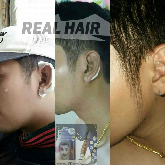ขายเป็น เซต 1,490 บาท Real Hair เรียล แฮร์ ปลูกผม ไรผม คิ้ว หนวด เครา จอน