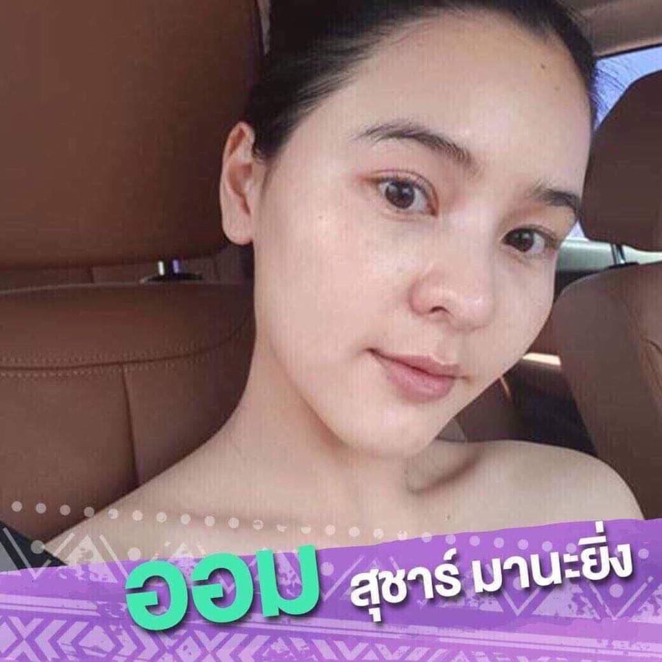 สารต้านอนุมูลอิสระสูง ซุปเปอร์ฟู้ดเพิ่มภูมิคุ้มกัน สุขภาพดีจากภายใน โนล่า อาซาอิ เบอร์รี่ NOLA Acai Berry โนลา