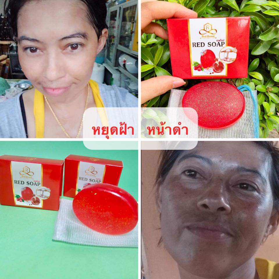 สบู่ รักษาฝ้า เรด โซป สบู่เรด สบู่เรดโซป red soap redsoap