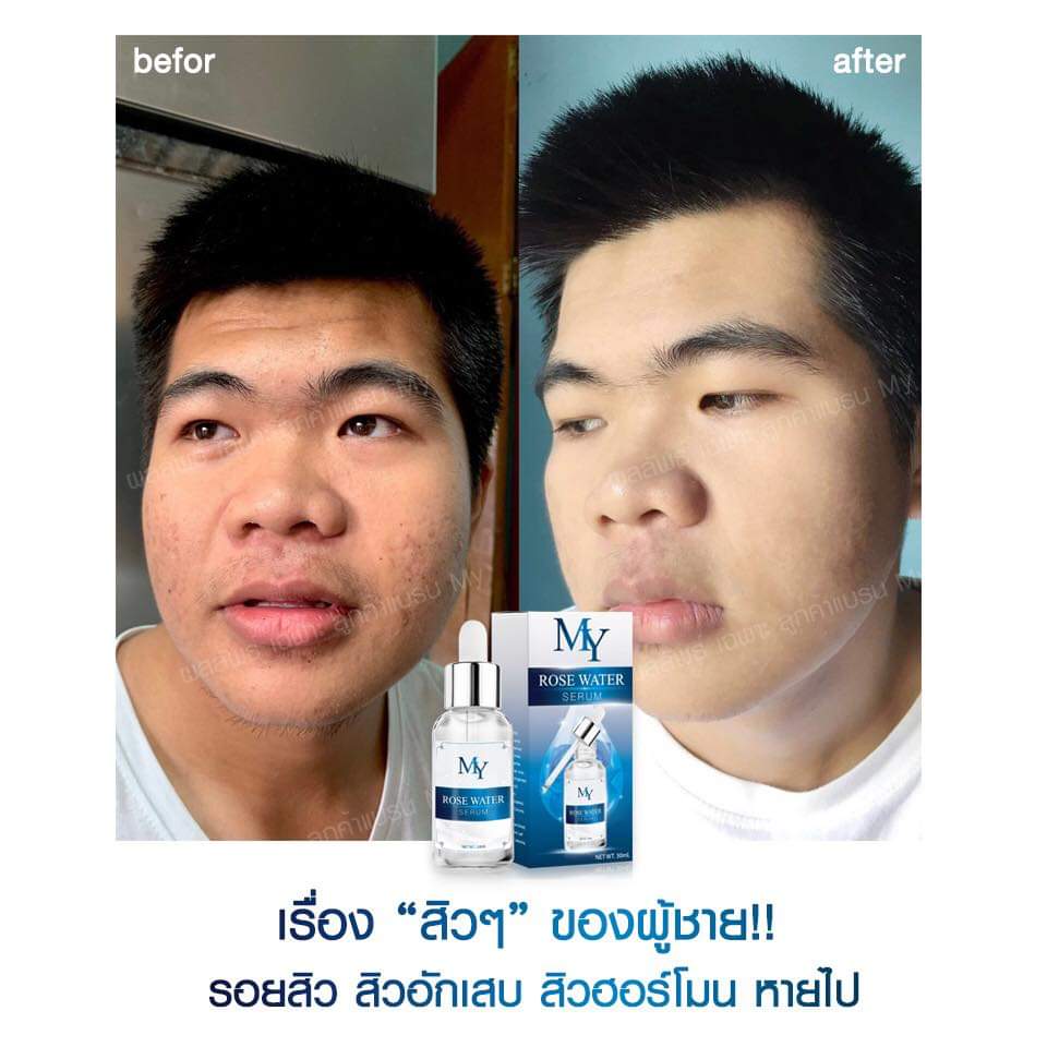 my rose serum เซรั่มสกัดจากน้ำดอกกุหลาบ และสารสกัดจากธรรมชาติ เซรั่มกุหลาบ