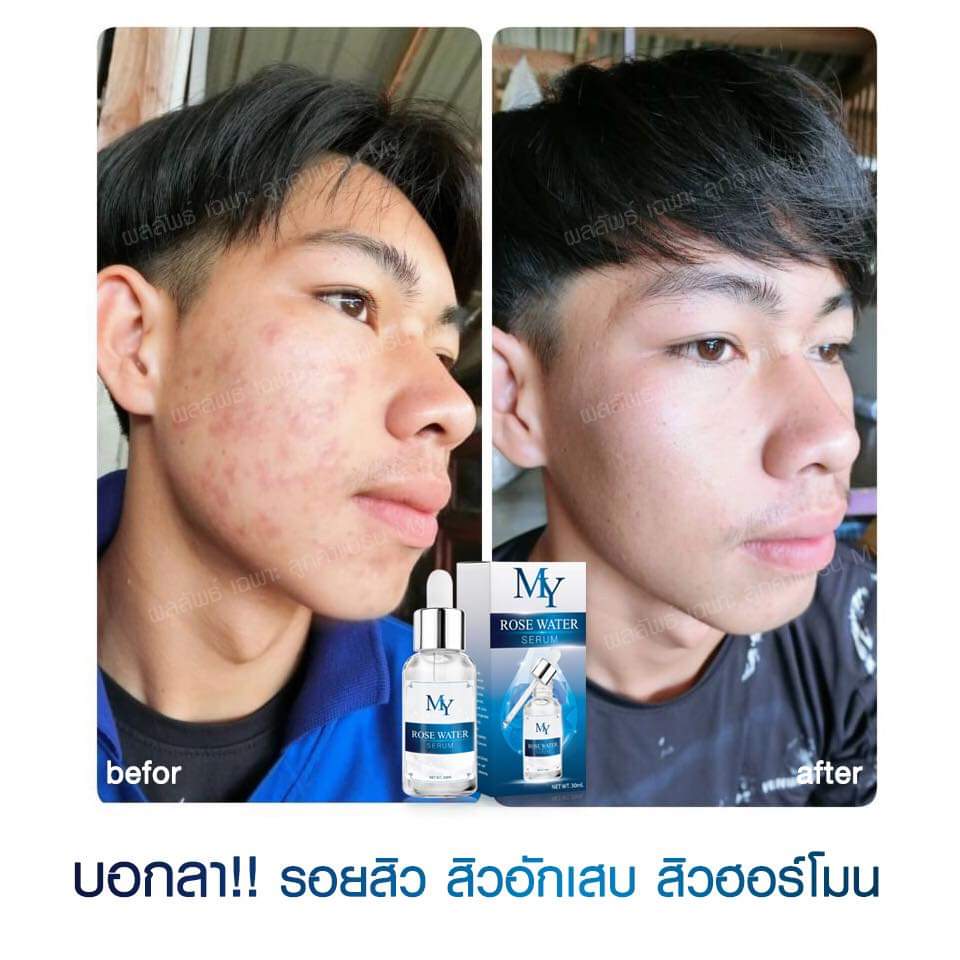 my rose serum เซรั่มสกัดจากน้ำดอกกุหลาบ และสารสกัดจากธรรมชาติ เซรั่มกุหลาบ