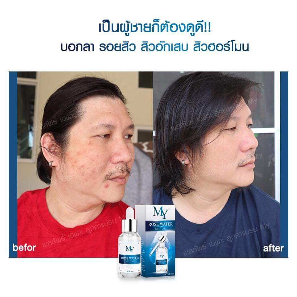 my rose serum เซรั่มสกัดจากน้ำดอกกุหลาบ และสารสกัดจากธรรมชาติ เซรั่มกุหลาบ