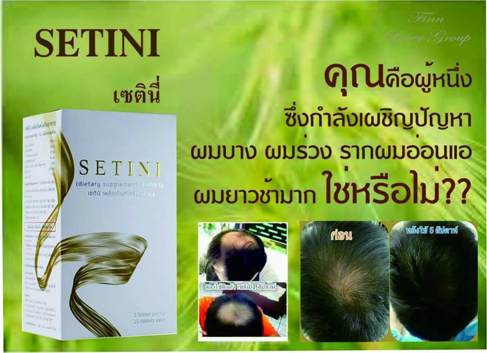 Setini เซตินิ อาหารเสริม บำรุงเส้นผม master piece life vision มาสเตอร์ พีซ ไลฟ์ วิชั่น