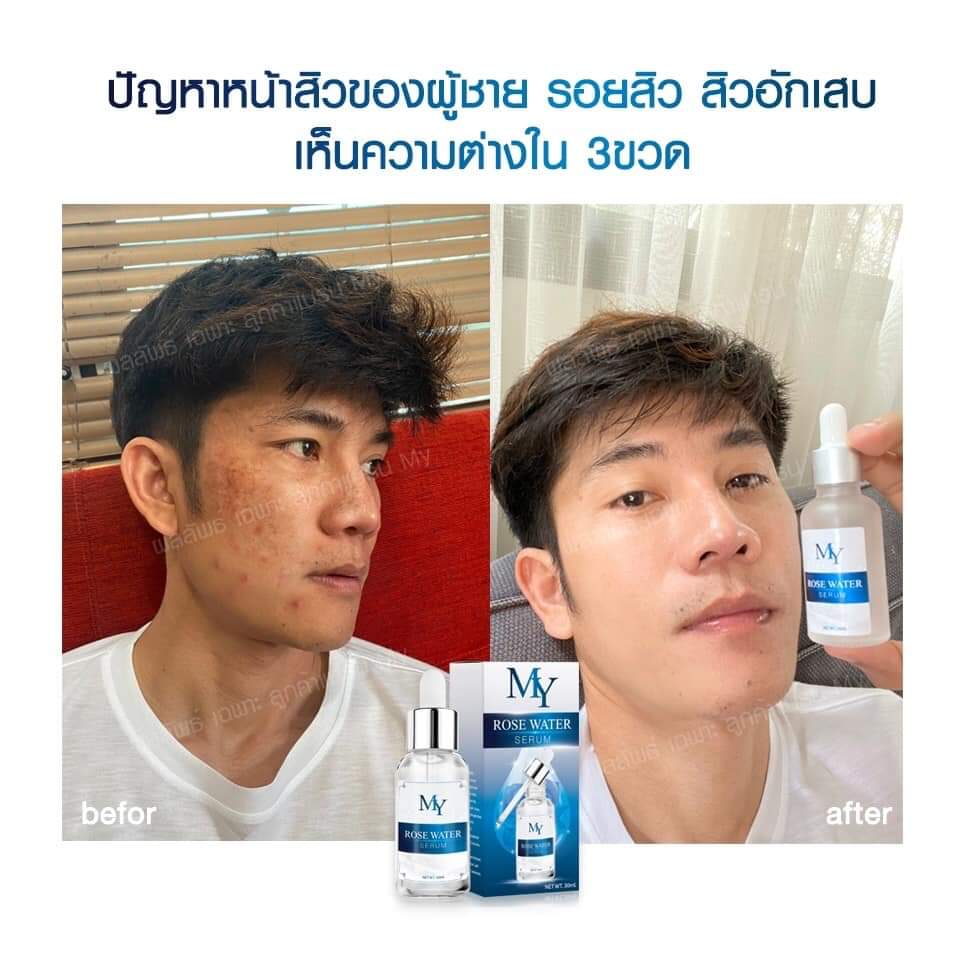 my rose serum เซรั่มสกัดจากน้ำดอกกุหลาบ และสารสกัดจากธรรมชาติ เซรั่มกุหลาบ