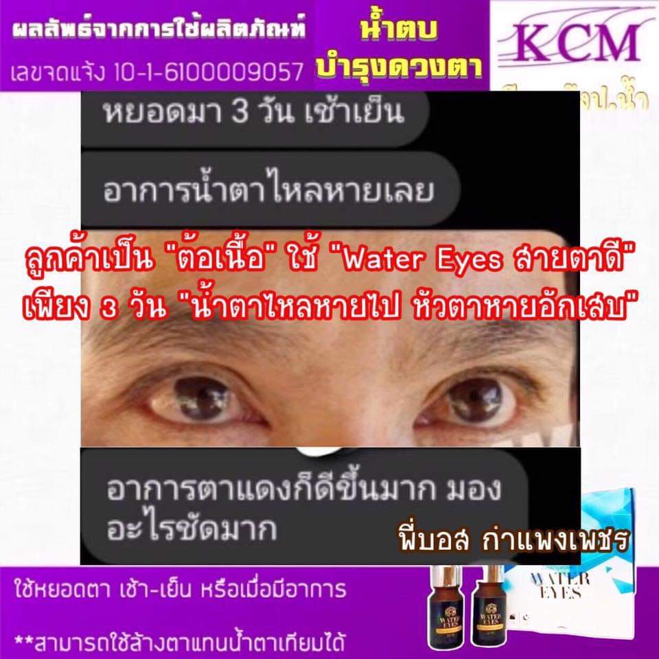 น้ำตบดูแลรอบดวงตา kcm water eyes วอเตอร์ อาย สมุนไพรบำรุงดวงตา