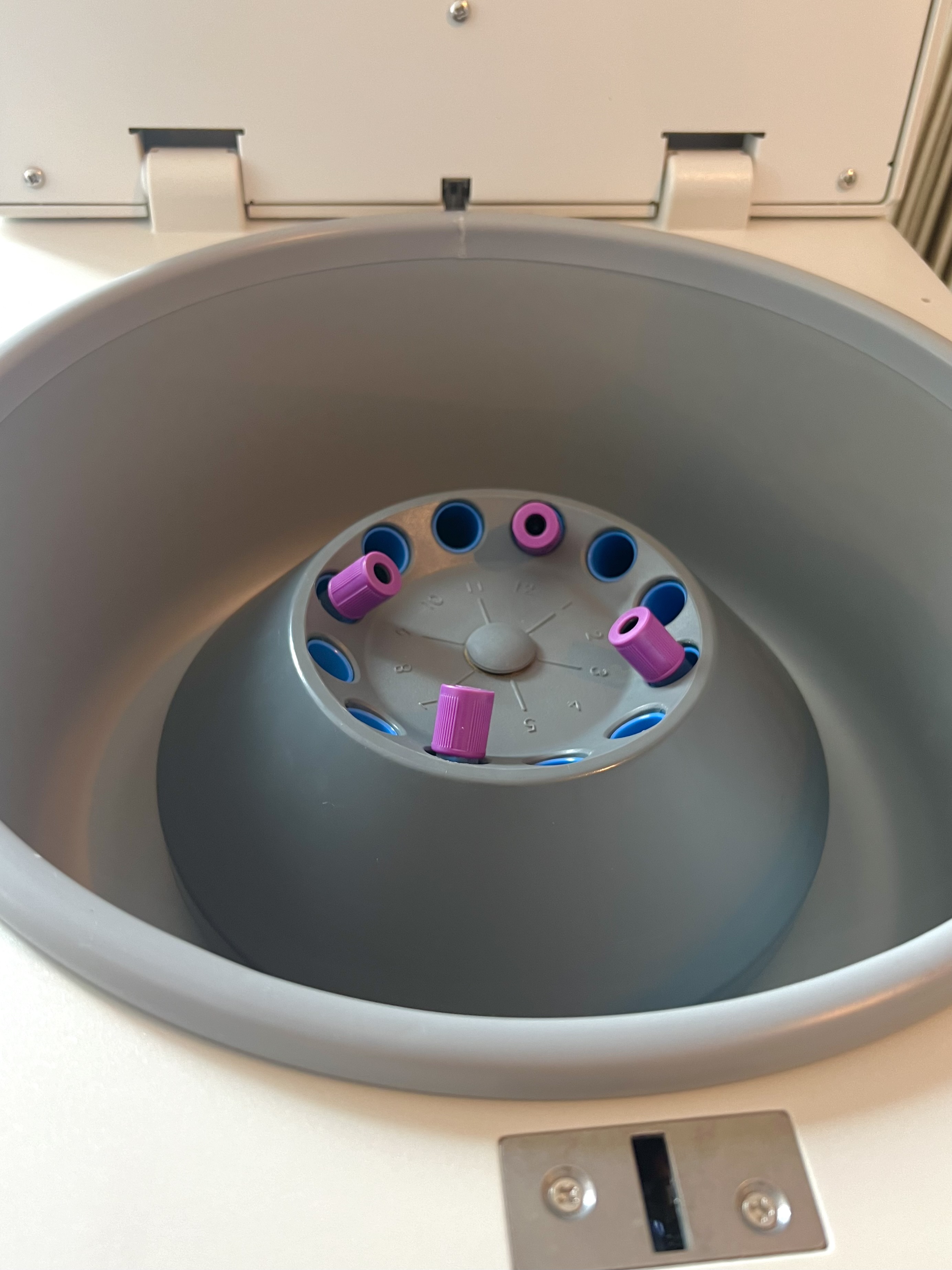 เครื่องปั่นเลือด Pre-program Blood, Urine & Faecal, DLAB