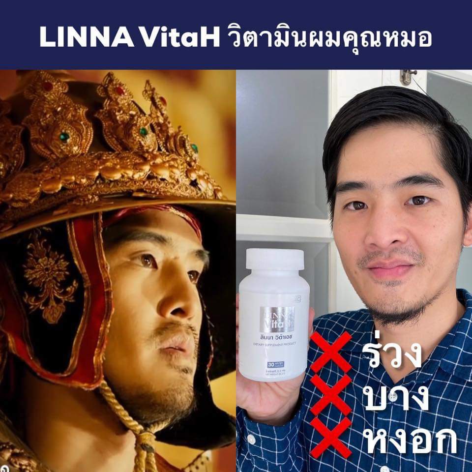 LINNA VitaH วิตามินผมหางม้า ลินนาแฮร์เซรั่ม linna hair serum แชมพู shampoo