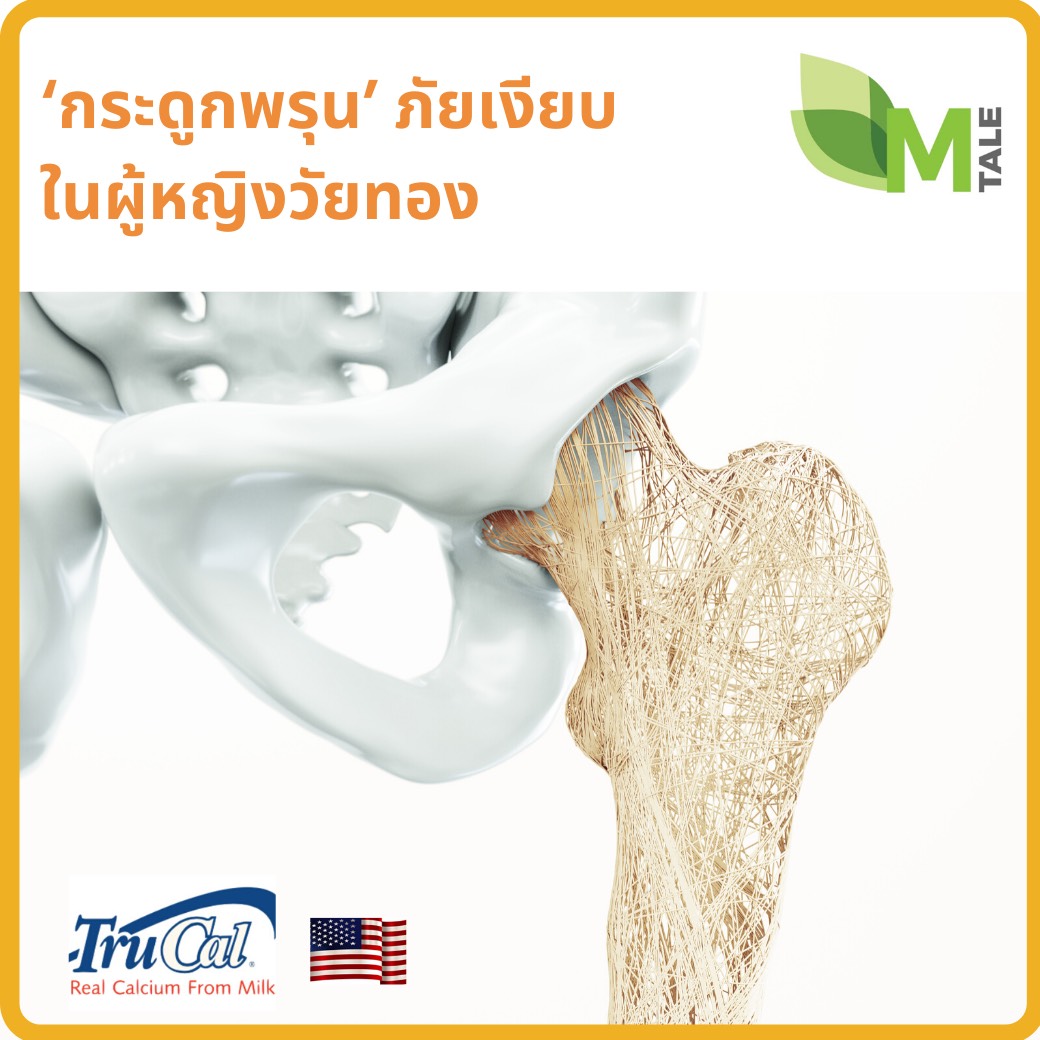 กระดูกพรุนวัยทอง