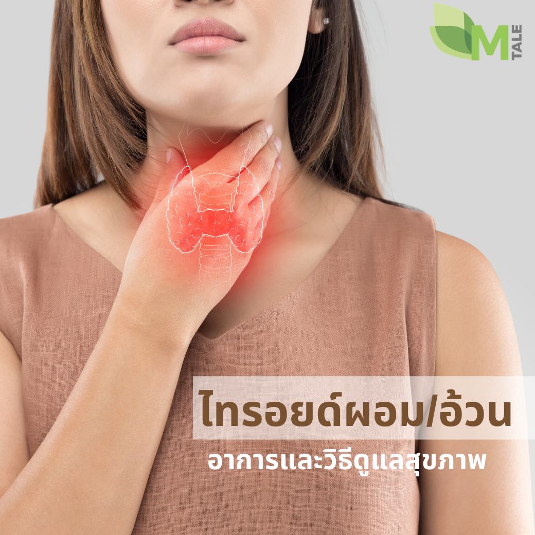 โรคไทรอยด์มีอาการคล้ายอาการวัยทอง