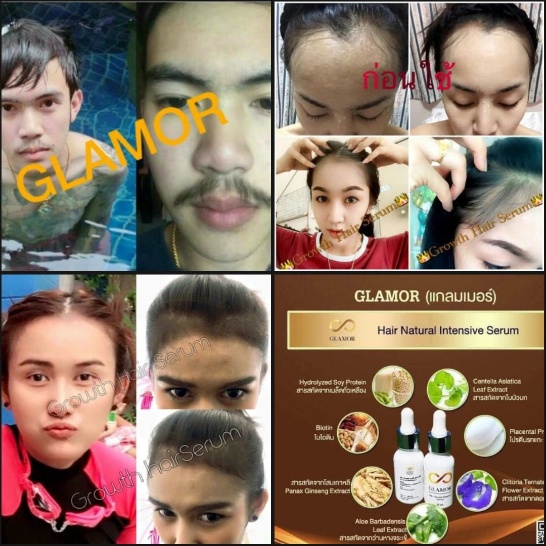 (1ขวด).Glamor Hair Serum แกรมเมอร์ แกลมเมอร์ แฮร์ เซรั่ม ปลูก ผม คิ้ว หนวด เครา จอน ไรผม ไลผม ปลูกผม ปลูกคิ้ว ปลูกขน ปลูกหนวด ปลูกเครา ปลูกไรผม