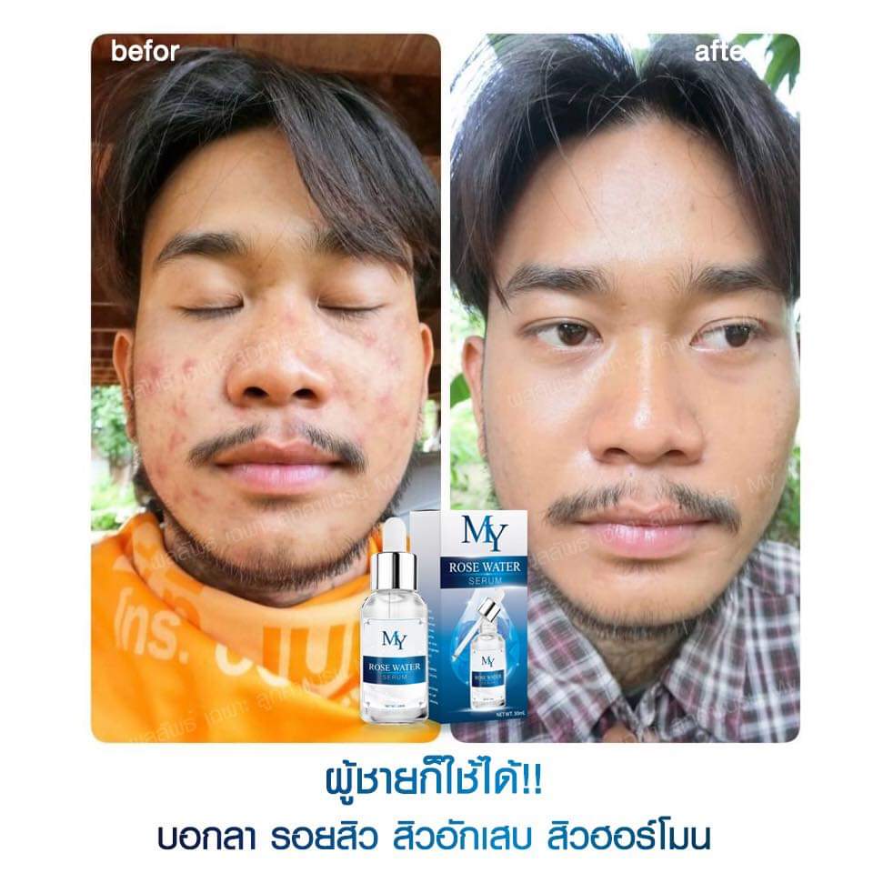 my rose serum เซรั่มสกัดจากน้ำดอกกุหลาบ และสารสกัดจากธรรมชาติ เซรั่มกุหลาบ